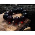  Huge Cherry Balls Amber Bracelet